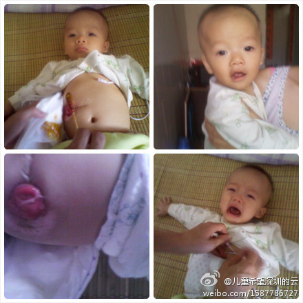 有时米糊要从另外一个口子里塞